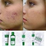 Gél na akné BioComplex - Master Herb 25 ml | tianDe